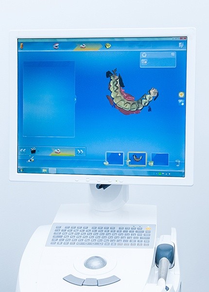 Digital imaging on chairside computer monitor